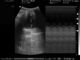Varredor médico ATNl51353 do ultrassom do trole da máquina móvel completa do ultrassom de Digitas mais 80 elementos fornecedor