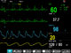 Monitor paciente modular de Oscillometry do multi parâmetro E12, exposição de TFT de 12 polegadas fornecedor
