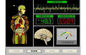 Ressonância magnética AH-Q9 do analisador inglês da saúde do corpo do quantum da versão fornecedor