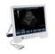 Sistema diagnóstico do ultrassom de TS20 Digitas para o departamento da obstetrícia e ginecologia fornecedor