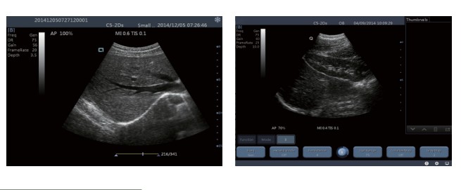 Sistema diagnóstico do ultrassom de TS20 Digitas para o departamento da obstetrícia e ginecologia