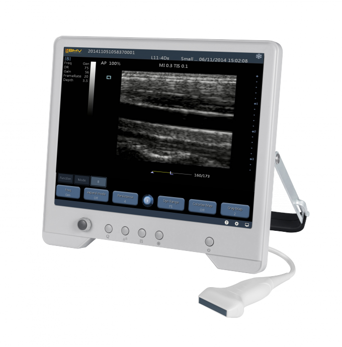 Sistema diagnóstico do ultrassom de TS20 Digitas para o departamento da obstetrícia e ginecologia